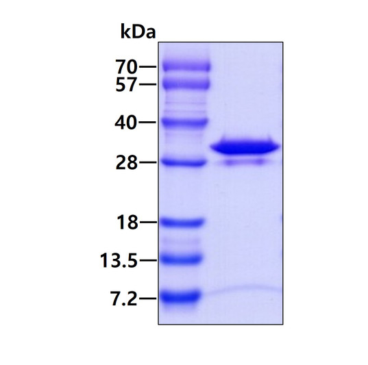 SDS-PAGE gel of recombinant human PMM2 protein under reducing conditions Coomassie blue stain