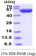 SDS-PAGE of recombinant human PD-ECGF TYMP protein under reducing conditions