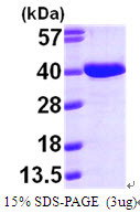 SDS-PAGE gel showing recombinant human AA protein 3µg under reducing conditions with Coomassie blue stain