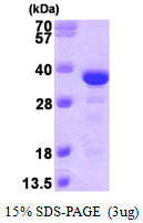 SDS-PAGE gel of recombinant human MAPRE3 protein under reducing conditions stained with Coomassie blue