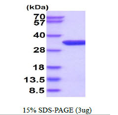 SDS-PAGE gel of recombinant human THYN1 protein 3µg under reducing conditions with Coomassie blue stain