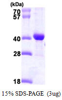 SDS-PAGE gel of recombinant human DNAJB2 protein 3µg under reducing conditions with Coomassie blue stain