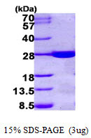 SDS-PAGE gel of recombinant human HDHD1A PUDP protein under reducing conditions