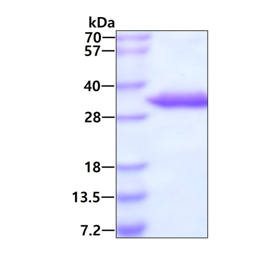 SDS-PAGE gel of recombinant human UCK2 protein stained with Coomassie blue