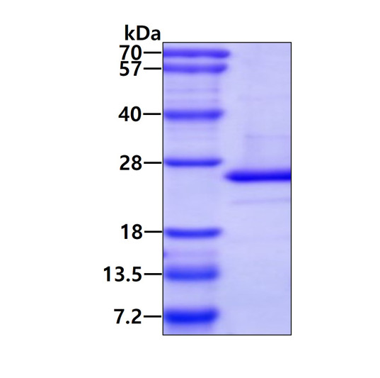 SDS-PAGE gel of recombinant human ARL5 ARL5A protein under reducing conditions stained with Coomassie blue