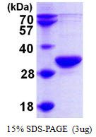 SDS-PAGE gel of recombinant human RPP30 protein under reducing conditions Coomassie blue stain