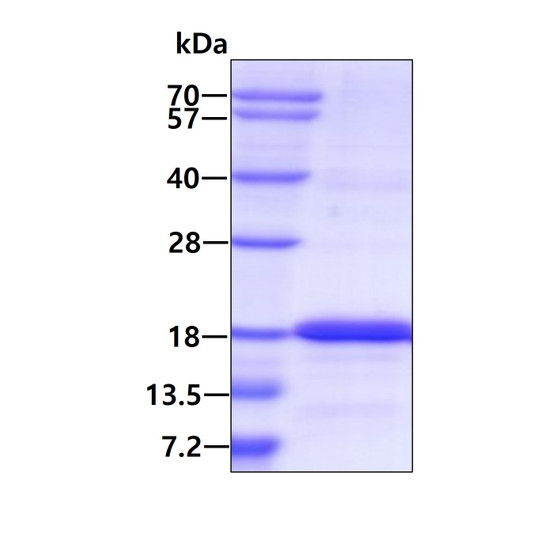 SDS-PAGE gel of recombinant human ISCU protein stained with Coomassie blue
