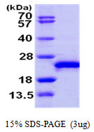 SDS-PAGE gel of recombinant human RAC3 protein under reducing conditions stained with Coomassie blue