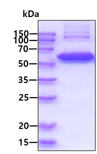 SDS-PAGE gel of recombinant human TXNRD1 protein under reducing conditions Coomassie stained