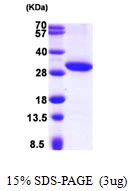 SDS-PAGE of recombinant human 17 beta-HSD11 HSD17B11 protein under reducing conditions
