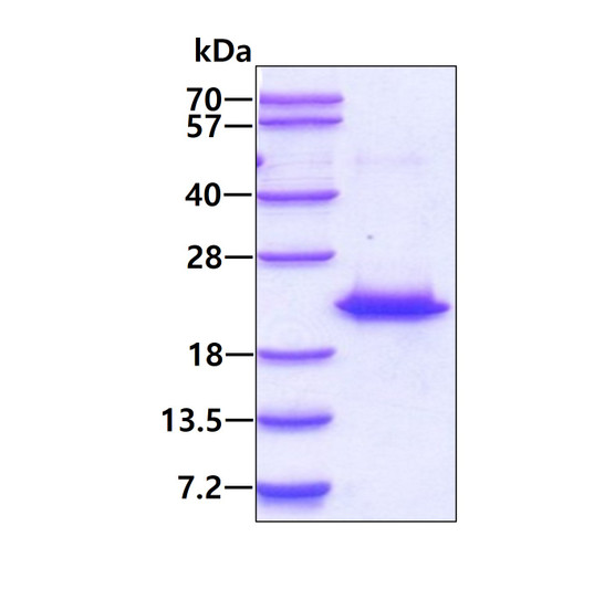 SDS-PAGE gel showing recombinant human CETN2 protein 3µg under reducing conditions stained with Coomassie blue
