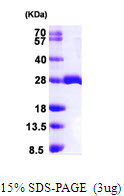SDS-PAGE gel of recombinant human MOBKL1B MOB1A protein under reducing conditions