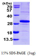 SDS-PAGE gel of recombinant human SCO2 protein under reducing conditions stained with Coomassie blue