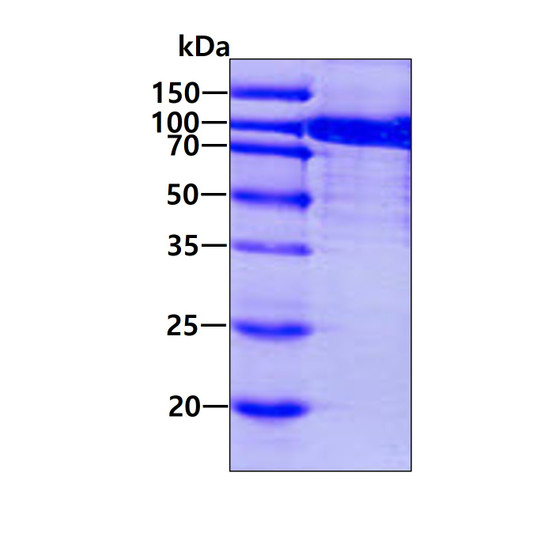 Recombinant human ACO1 protein SDS-PAGE gel under reducing conditions stained with Coomassie blue