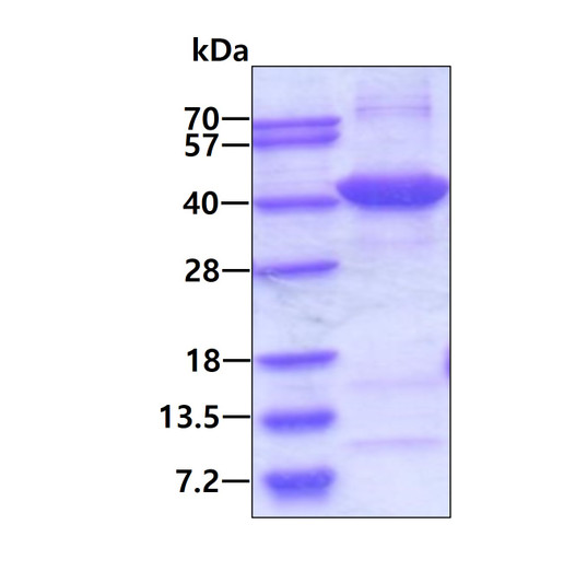 SDS-PAGE gel of recombinant human NMI protein under reducing conditions stained with Coomassie blue