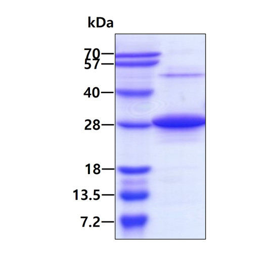 SDS-PAGE of recombinant human RAB7A protein under reducing conditions stained with Coomassie blue