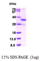 SDS-PAGE of recombinant human DDIT4 protein 3 µg under reducing conditions with Coomassie blue stain