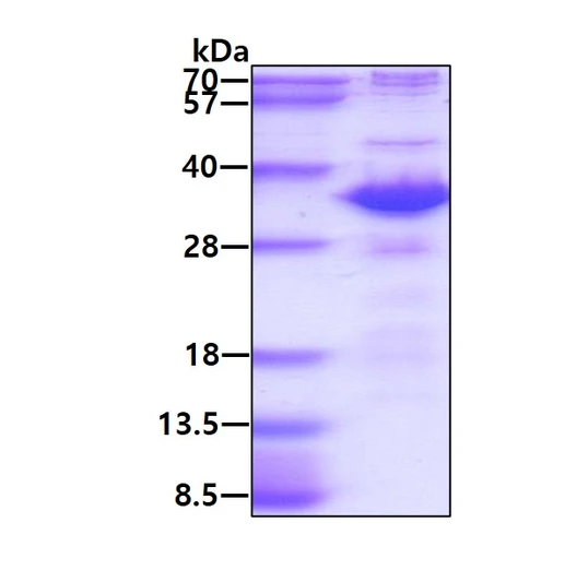 Recombinant human ATG5 protein SDS-PAGE gel under reducing conditions stained with Coomassie blue