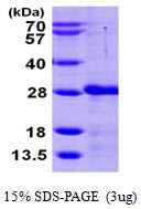 SDS-PAGE gel of recombinant human CIB2 protein under reducing conditions stained with Coomassie blue