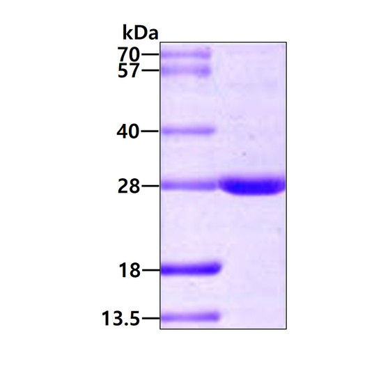 SDS-PAGE of recombinant human BAG2 protein 3μg under reducing conditions stained with Coomassie blue