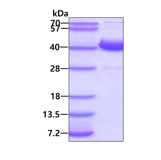 SDS-PAGE gel of recombinant human AKR1D1 protein under reducing conditions stained with Coomassie blue