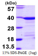 SDS-PAGE gel of recombinant human EF-1 delta EEF1D protein under reducing conditions Coomassie blue stain