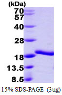 SDS-PAGE gel of recombinant human A2LD1 GGACT protein under reducing conditions stained with Coomassie blue