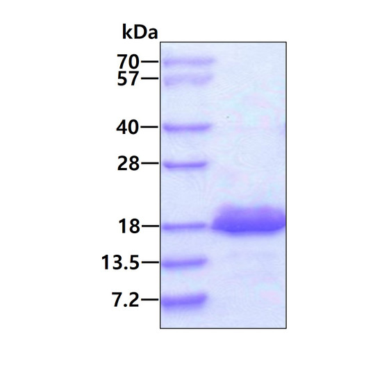 SDS-PAGE gel of recombinant human 4E-BP2 EIF4EBP2 protein under reducing conditions