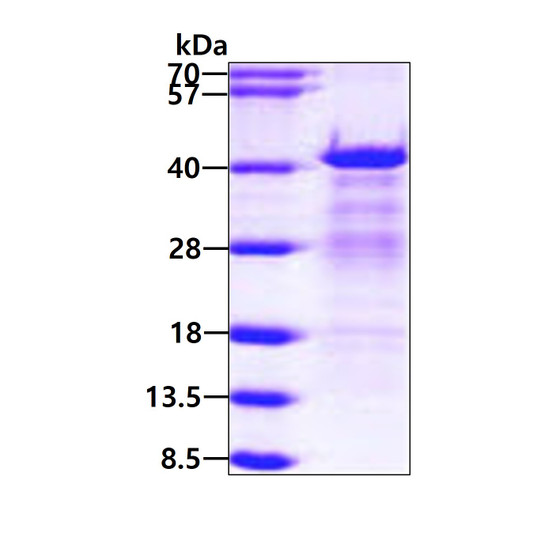 SDS-PAGE of recombinant human HNRNPC protein under reducing conditions with Coomassie blue stain