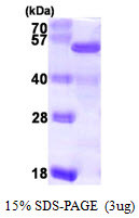 SDS-PAGE of recombinant human RDBP NELFE protein under reducing conditions