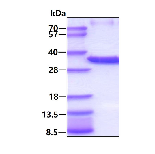 SDS-PAGE gel of recombinant human 17 beta-HSD8 HSD17B8 protein under reducing conditions