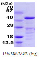 SDS-PAGE gel of recombinant human VASP protein 3μg reducing conditions Coomassie stain