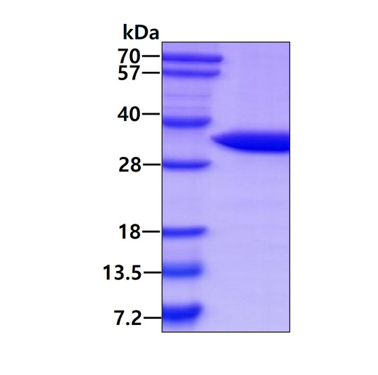 SDS-PAGE gel of recombinant human CLIC2 protein stained with Coomassie blue