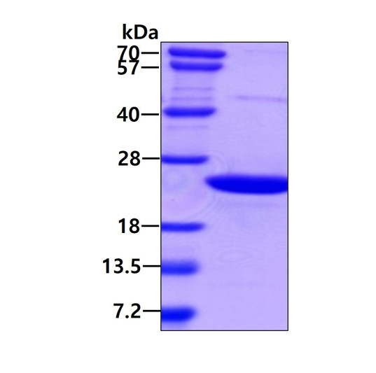 SDS-PAGE of recombinant human AIMP3 EEF1E1 protein under reducing conditions stained with Coomassie blue