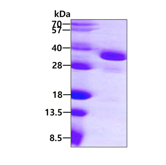 SDS-PAGE gel of recombinant human eIF-2B alpha EIF2B1 protein under reducing conditions