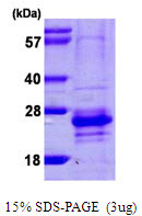 SDS-PAGE gel of recombinant human CABP7 protein under reducing conditions