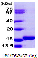 SDS-PAGE gel of recombinant human LC3B MAP1LC3B protein under reducing conditions