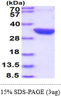 SDS-PAGE gel of recombinant E. coli glsA1 protein under reducing conditions Coomassie blue stain