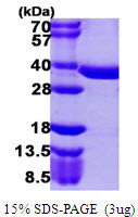 SDS-PAGE gel of recombinant human PPCS protein 3 µg under reducing conditions with Coomassie blue staining