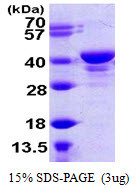 SDS-PAGE gel of recombinant human UCH-L5 UCH37 protein under reducing conditions