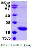 SDS-PAGE gel of recombinant human TSEN15 protein under reducing conditions