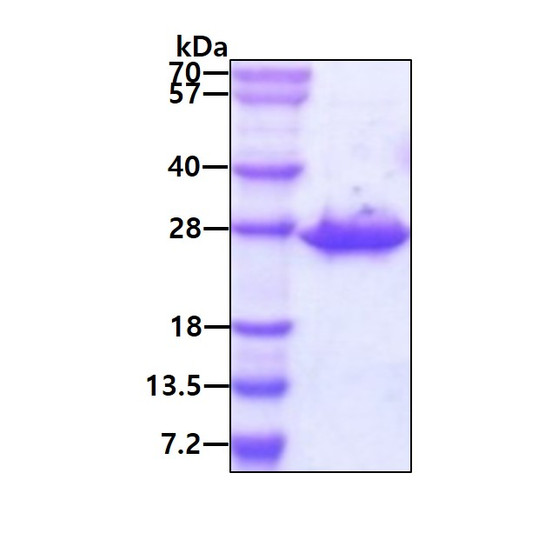 SDS-PAGE of recombinant human CLPP protein 3µg under reducing conditions stained with Coomassie blue
