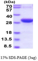 SDS-PAGE of recombinant human Synaptotagmin-1 protein under reducing conditions Coomassie blue stain