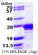 SDS-PAGE of recombinant human RAB2A protein under reducing conditions Coomassie blue stain