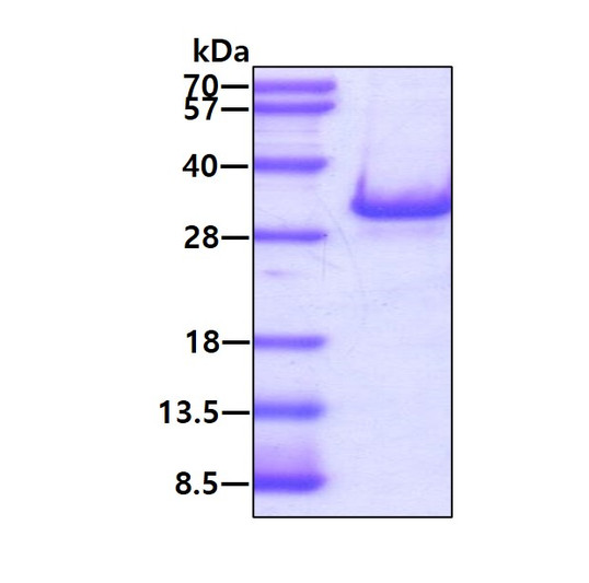 SDS-PAGE gel showing recombinant human RAB3D protein 3ug under reducing conditions Coomassie blue stain