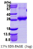 SDS-PAGE gel of recombinant human RAB3A protein under reducing conditions Coomassie blue stain