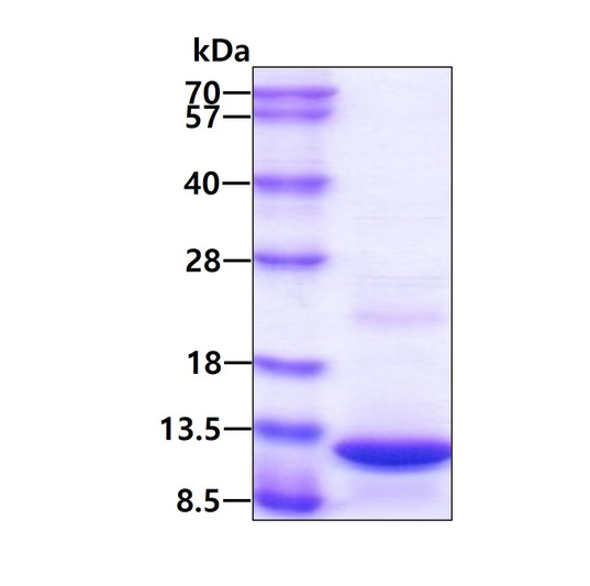 SDS-PAGE gel of recombinant human PPBP CXCL7 protein under reducing conditions