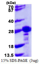 SDS-PAGE gel of recombinant human CBX1 protein under reducing conditions stained with Coomassie blue