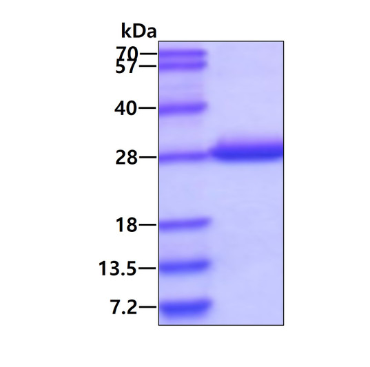 SDS-PAGE gel showing recombinant human DTYMK protein 3µg under reducing conditions with Coomassie blue staining