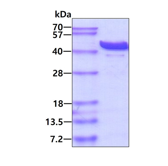 SDS-PAGE gel showing recombinant human ADA protein 3µg under reducing conditions with Coomassie blue staining